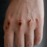 Lukas Lerager injury