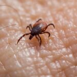 Tick on skin