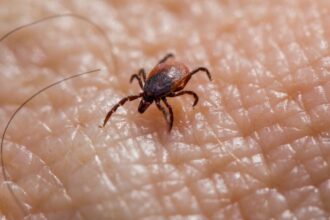 Tick on skin